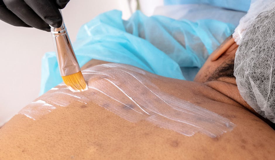 A person lying face down, wearing a blue protective covering and hairnet, while another person applies a white substance onto their upper back using a brush. The second person is wearing black gloves. The scene suggests a skincare treatment or medical procedure.